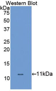 Polyclonal Antibody to Dopamine Transporter (DAT)