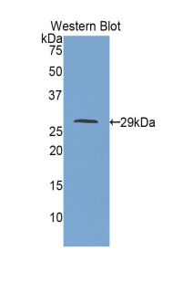 Polyclonal Antibody to Insulin Like Growth Factor 2 Receptor (IGF2R)