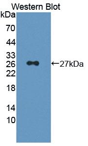 Polyclonal Antibody to Prostaglandin D2 Synthase (PTGDS)