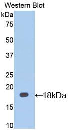 Polyclonal Antibody to Interleukin 13 Receptor Alpha 1 (IL13Ra1)