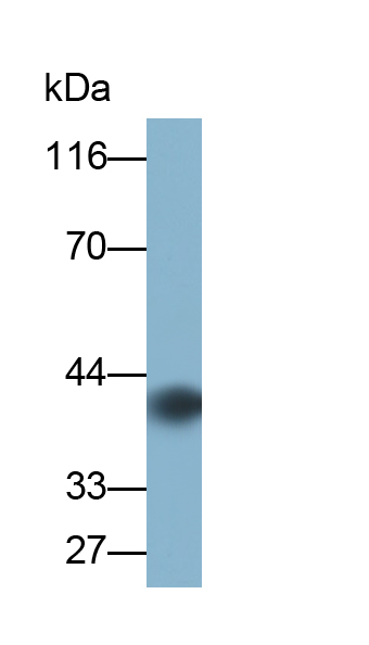 Polyclonal Antibody to Interleukin 13 Receptor Alpha 2 (IL13Ra2)