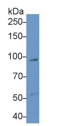 Polyclonal Antibody to Interleukin 17 Receptor A (IL17RA)