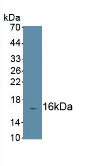 Polyclonal Antibody to Chemokine C-C-Motif Receptor 7 (CCR7)