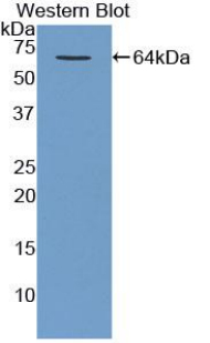 Polyclonal Antibody to Major Basic Protein (MBP)