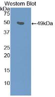 Polyclonal Antibody to Major Basic Protein (MBP)