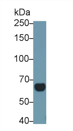 Polyclonal Antibody to Interleukin 18 Receptor 1 (IL18R1)