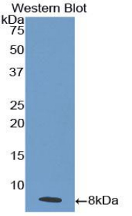 Polyclonal Antibody to Interleukin 18 Receptor 1 (IL18R1)