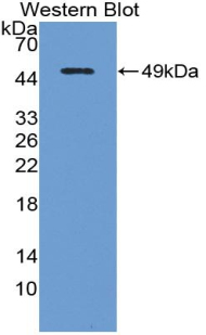 Polyclonal Antibody to Interleukin-18 Receptor Beta (IL18R Beta)