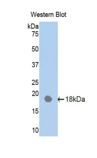 Polyclonal Antibody to Interleukin-18 Receptor Beta (IL18R Beta)