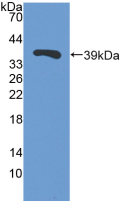 Polyclonal Antibody to Trefoil Factor 3 (TFF3)