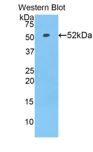 Polyclonal Antibody to Solute Carrier Family 27 Member 5 (SLC27A5)