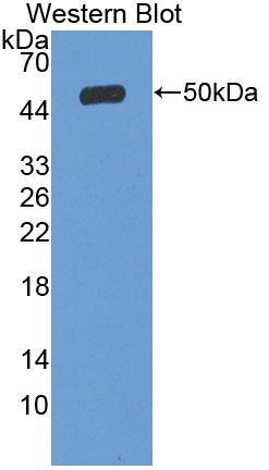 Polyclonal Antibody to Solute Carrier Family 27 Member 5 (SLC27A5)