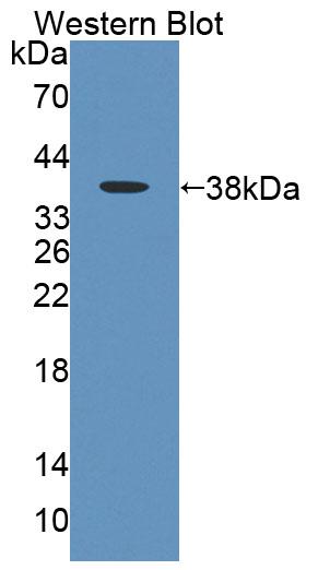 Polyclonal Antibody to Malonyl Coenzyme A Decarboxylase (MLYCD)