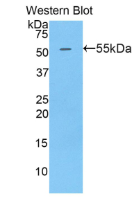 Polyclonal Antibody to Golgi Phosphoprotein 2 (GOLPH2)