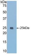 Polyclonal Antibody to Insulin Like Growth Factor Binding Protein 7 (IGFBP7)