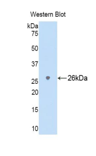 Polyclonal Antibody to Cluster Of Differentiation 229 (CD229)