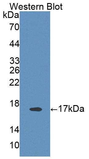 Polyclonal Antibody to Band 3 (BND3)