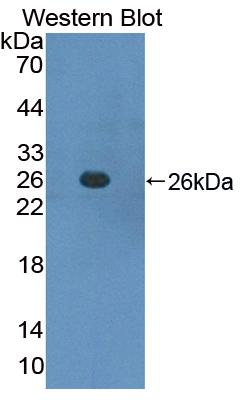 Polyclonal Antibody to Suppressors Of Cytokine Signaling 3 (SOCS3)