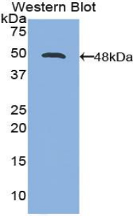 Polyclonal Antibody to Interleukin 21 (IL21)