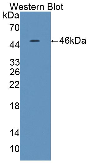 Polyclonal Antibody to Interleukin 21 (IL21)