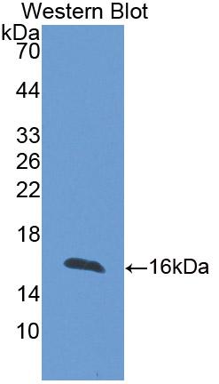 Polyclonal Antibody to Fatty Acid Binding Protein 4 (FABP4)