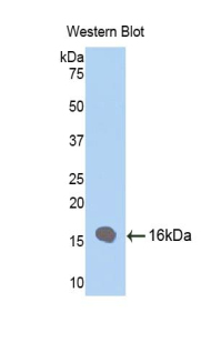 Biotin-Linked Polyclonal Antibody to Fatty Acid Binding Protein 4 (FABP4)