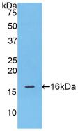 Polyclonal Antibody to Fatty Acid Binding Protein 4 (FABP4)