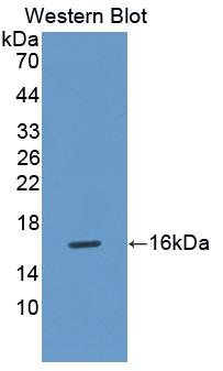 Polyclonal Antibody to Fatty Acid Binding Protein 4 (FABP4)