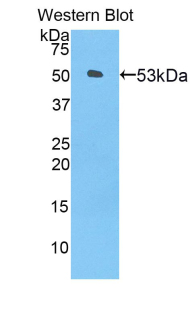 Polyclonal Antibody to Angiopoietin Like Protein 3 (ANGPTL3)