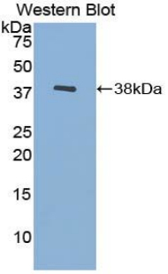 Polyclonal Antibody to TATA Binding Protein (TBP)
