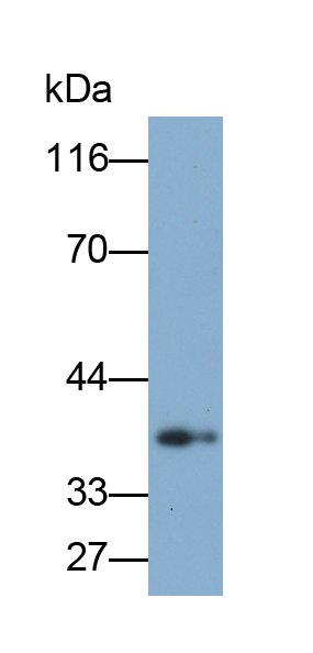 Polyclonal Antibody to TATA Binding Protein (TBP)