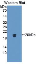 Polyclonal Antibody to Glycophorin A (GYPA)