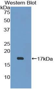 Polyclonal Antibody to T-Cell Leukemia/Lymphoma Protein 1A (TCL1A)