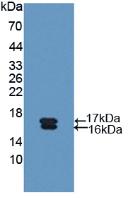 Polyclonal Antibody to Glycocalicin (GC)