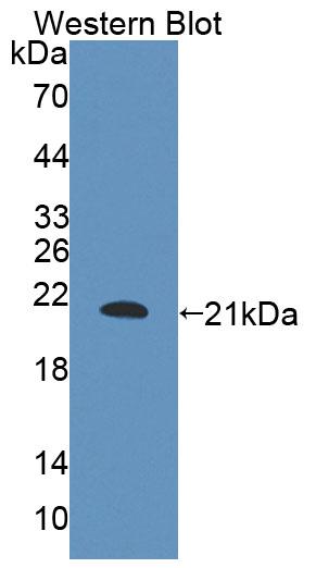 Polyclonal Antibody to B And T-Lymphocyte Attenuator (BTLA)