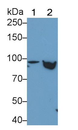 Polyclonal Antibody to Signal Transducer And Activator Of Transcription 5B (STAT5B)