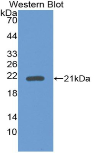 Polyclonal Antibody to Bone Morphogenetic Protein 9 (BMP9)