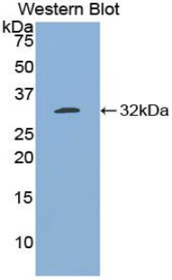 Polyclonal Antibody to B-Cell CLL/Lymphoma 3 (Bcl3)