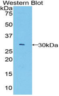 Polyclonal Antibody to B-Cell CLL/Lymphoma 3 (Bcl3)