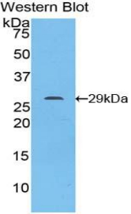 Polyclonal Antibody to Signal Transducer And Activator Of Transcription 6 (STAT6)