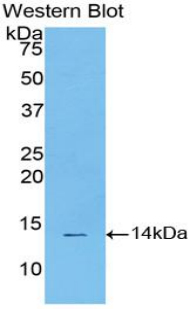 Polyclonal Antibody to Signal Transducer And Activator Of Transcription 3 (STAT3)