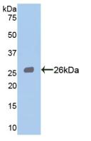 Polyclonal Antibody to Signal Transducer And Activator Of Transcription 3 (STAT3)