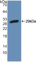 Polyclonal Antibody to Phosphofructokinase, Platelet (PFKP)