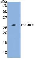 Polyclonal Antibody to Tryptophanyl tRNA Synthetase (WARS)