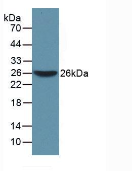 Polyclonal Antibody to Tryptophanyl tRNA Synthetase (WARS)