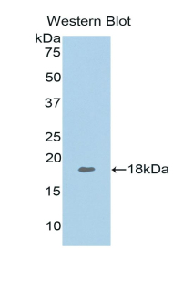 Polyclonal Antibody to Tumor Necrosis Factor Ligand Superfamily, Member 13 (TNFSF13)