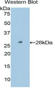 PAB752Hu01.jpg