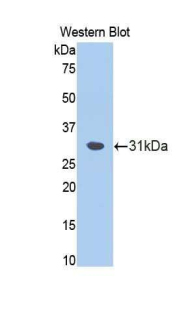 Polyclonal Antibody to Fascin (FSCN)