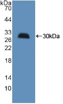 Polyclonal Antibody to Hydroxymethylglutaryl Coenzyme A Synthase (HMGCS)