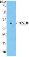 Polyclonal Antibody to Oncostatin M Receptor (OSMR)